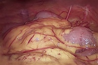 Toxic Fat